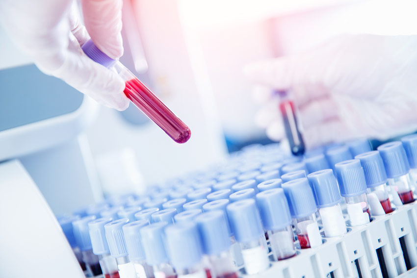 Blood test