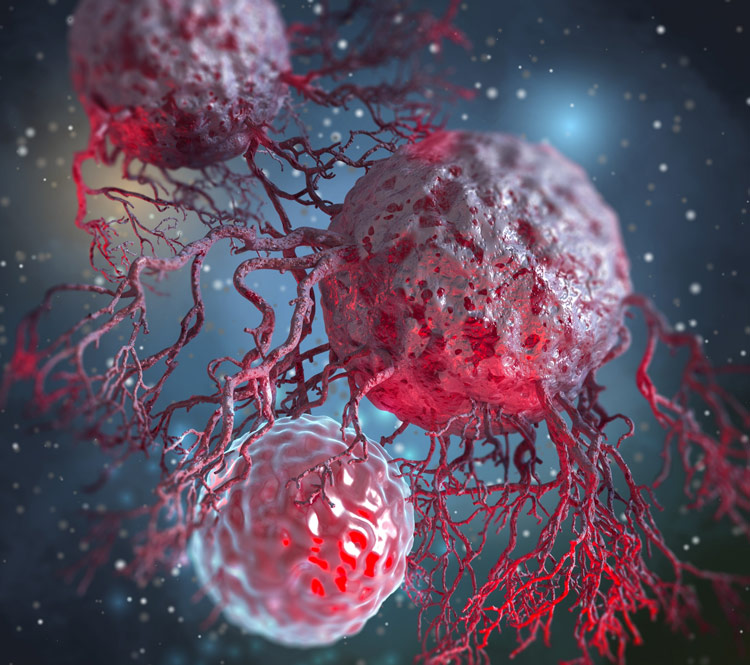 Cancer Cells